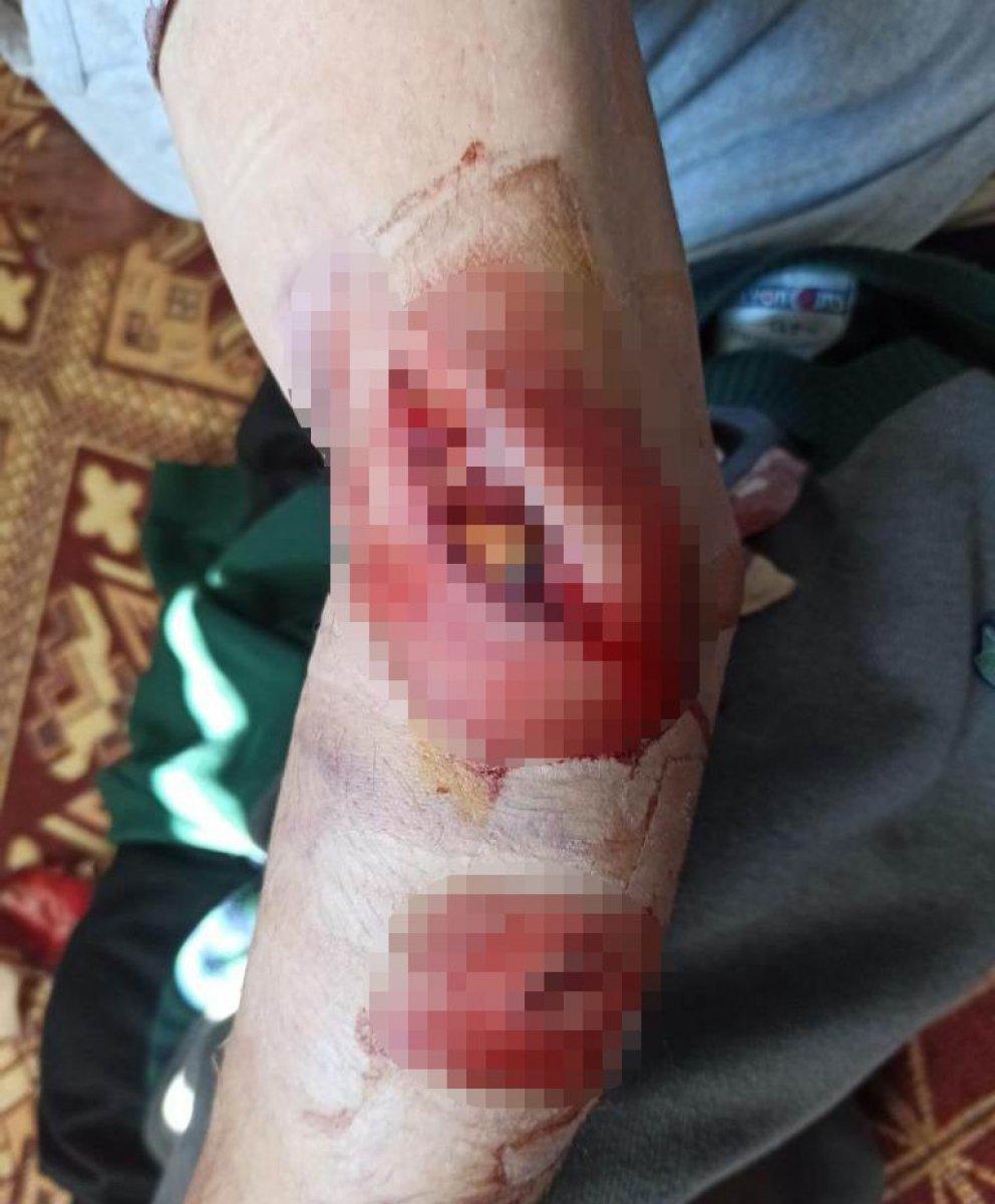 Bingöl'de yaşlı adam başıboş köpeğin saldırısına uğradı