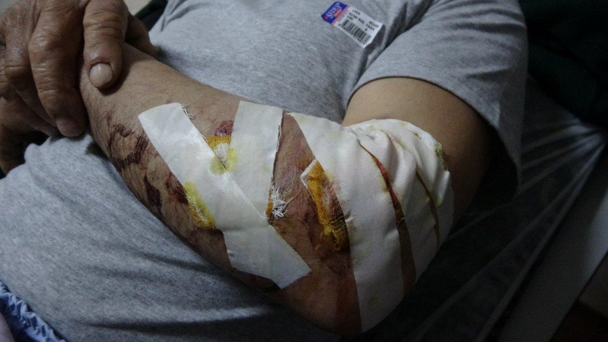 Bingöl'de yaşlı adam başıboş köpeğin saldırısına uğradı