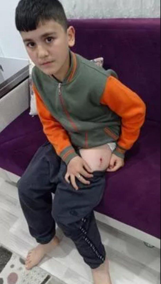 Antalya’da, annesiyle markete giden çocuğu köpek ısırdı