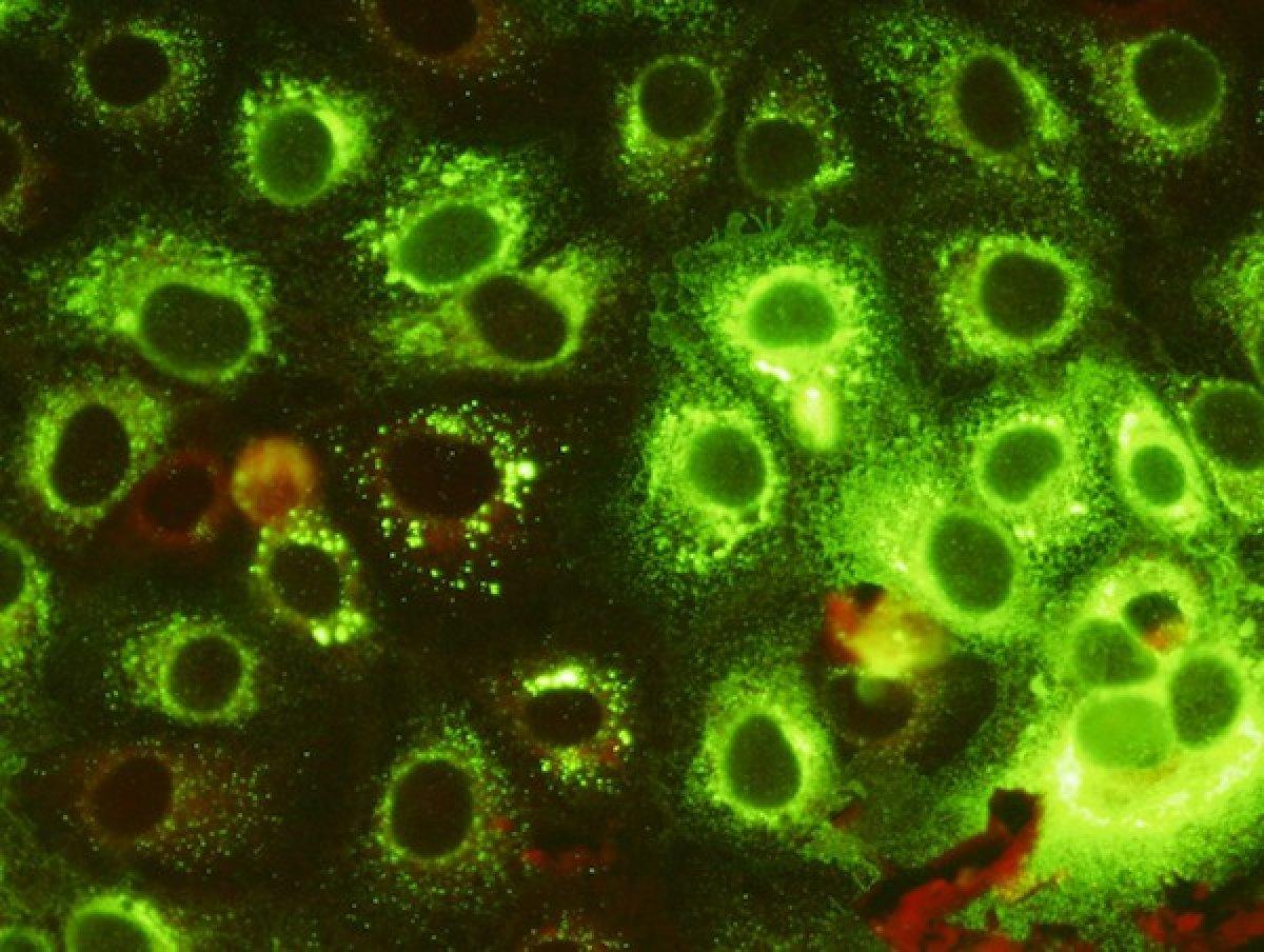 Ne korona, ne omicron! Beyni iltihaplandıran yeni virüsün adı...