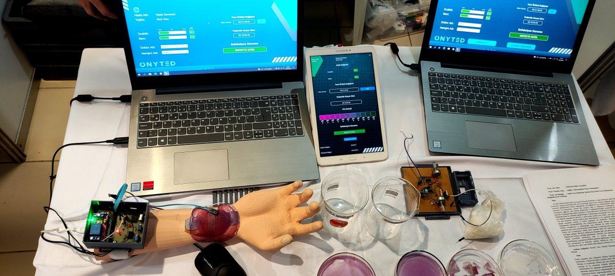 Bursa’da lise öğrencisi, yaraları iyileştiren cihaz geliştirdi