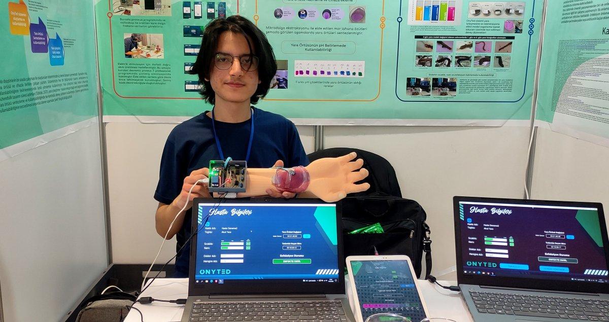 Bursa’da lise öğrencisi, yaraları iyileştiren cihaz geliştirdi