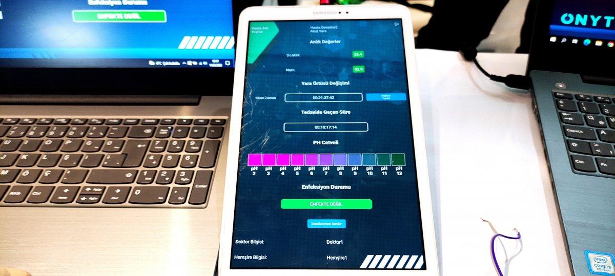 Bursa’da lise öğrencisi, yaraları iyileştiren cihaz geliştirdi