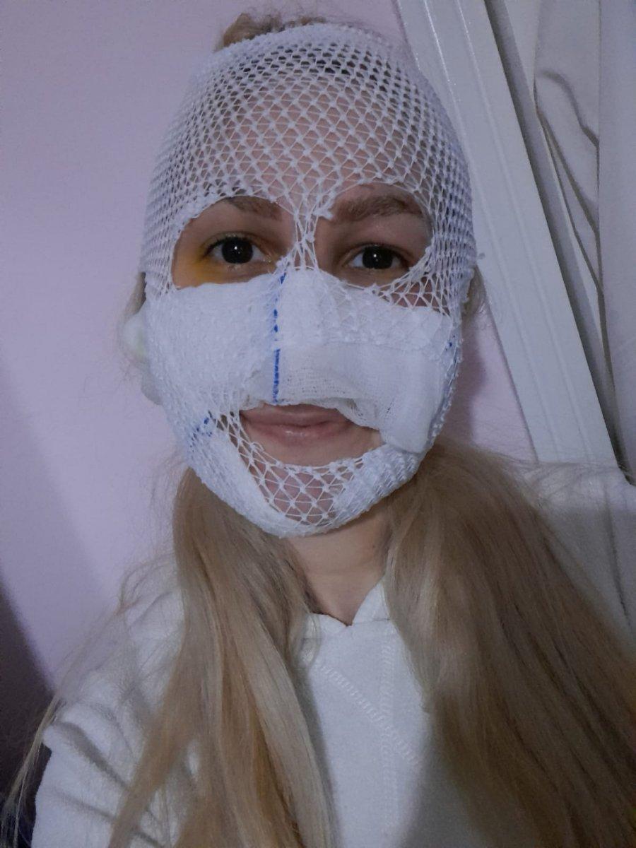 Ankara'da genç kızın yüzünü kimyasalla yakan şahsa yakalama kararı