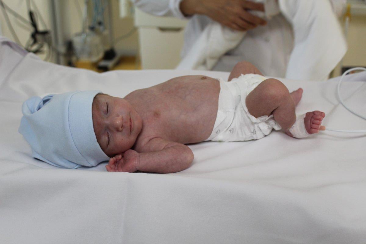Tekirdağ’da 1.300 gram doğan Ayaz bebek, hayata tutundu