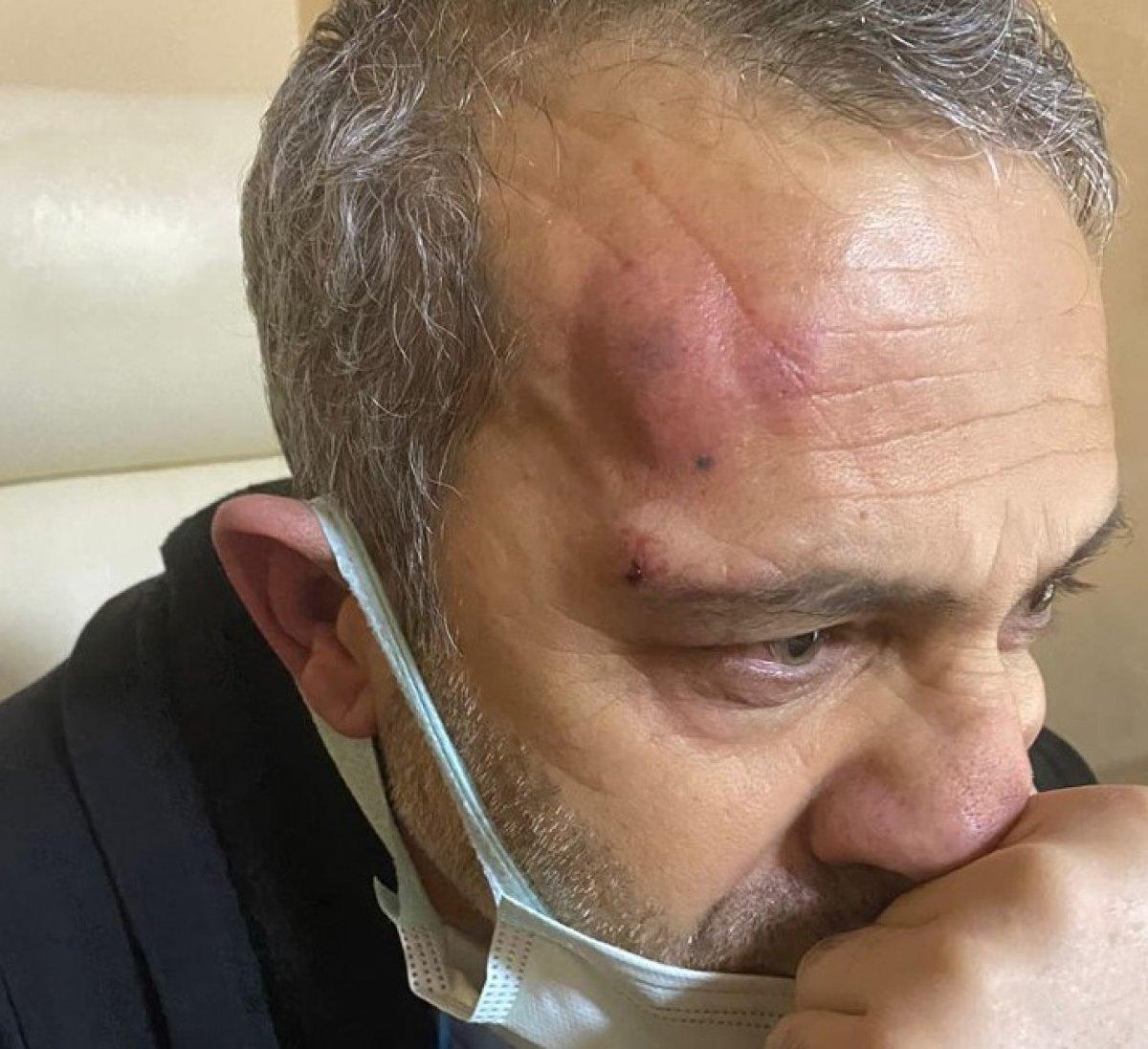 Şanlıurfa'da hemşireyi darbeden 2 hasta yakını tutuklandı