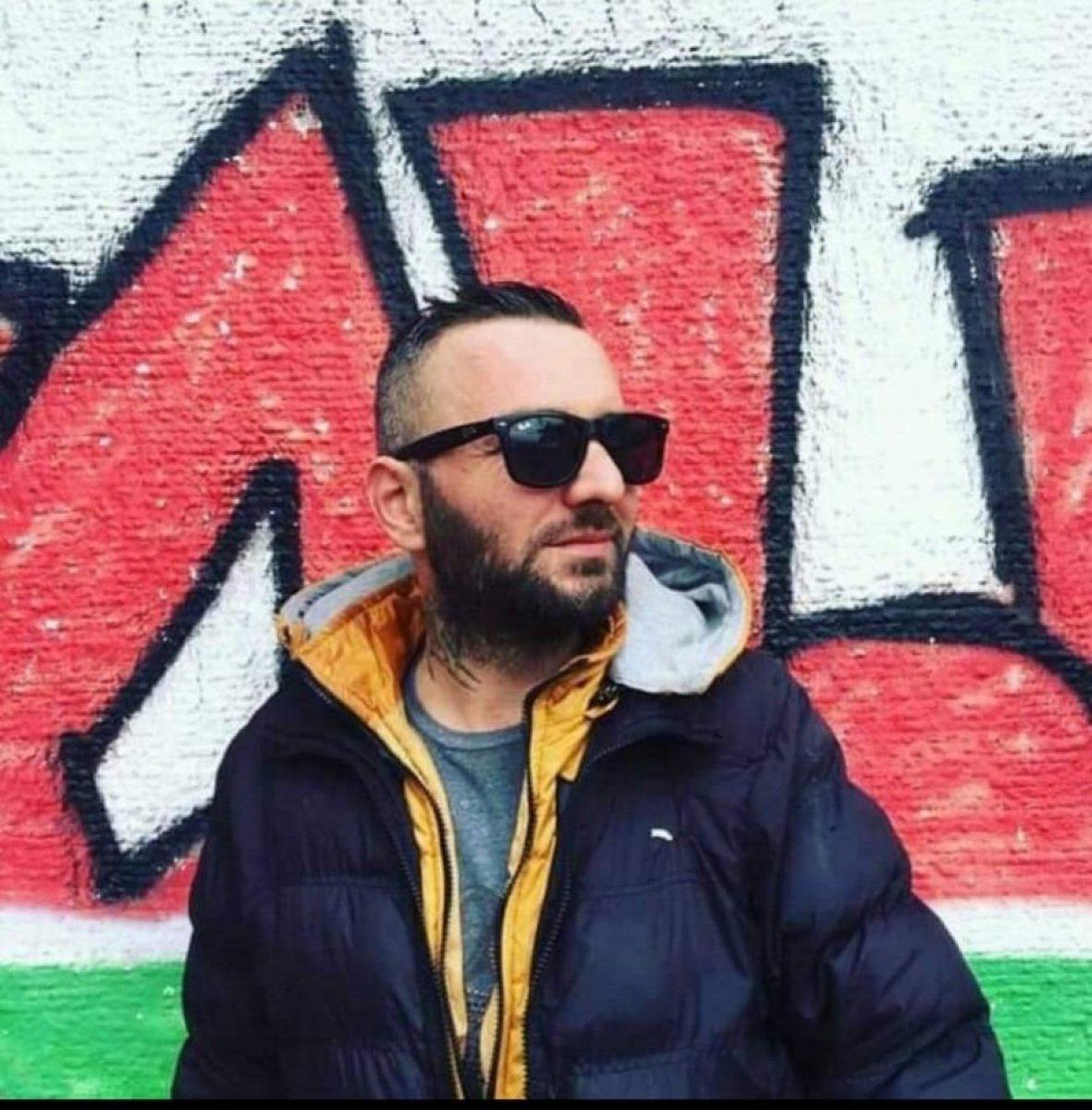 Ankara'da Sultan'ın yüzüne kimyasal madde atan şahıs yakalandı