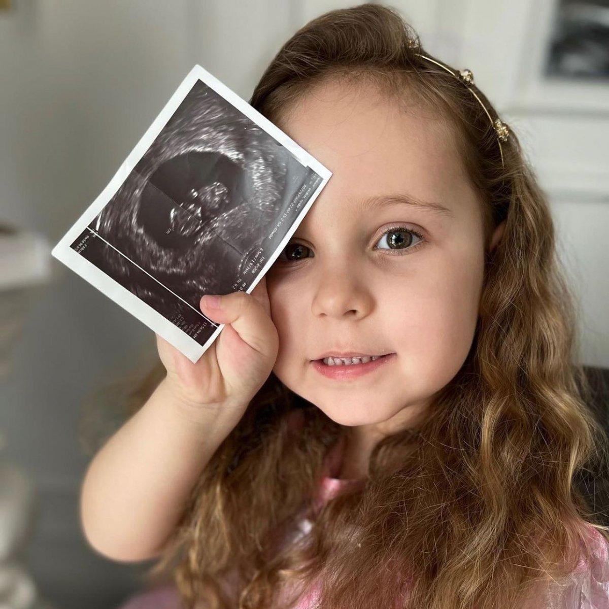 Ümit Erdim ikinci kez baba oluyor