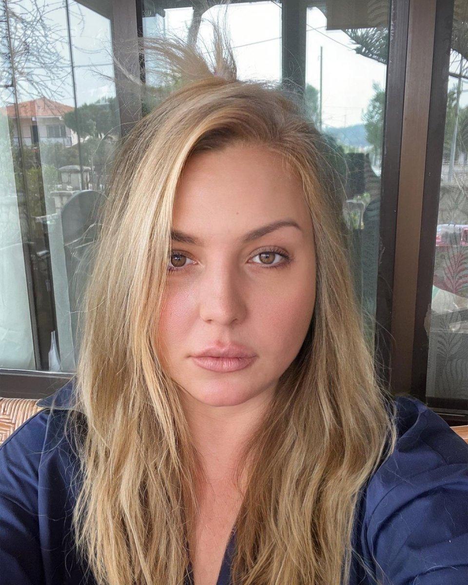 Seda Akgül'ün son hali şaşırttı