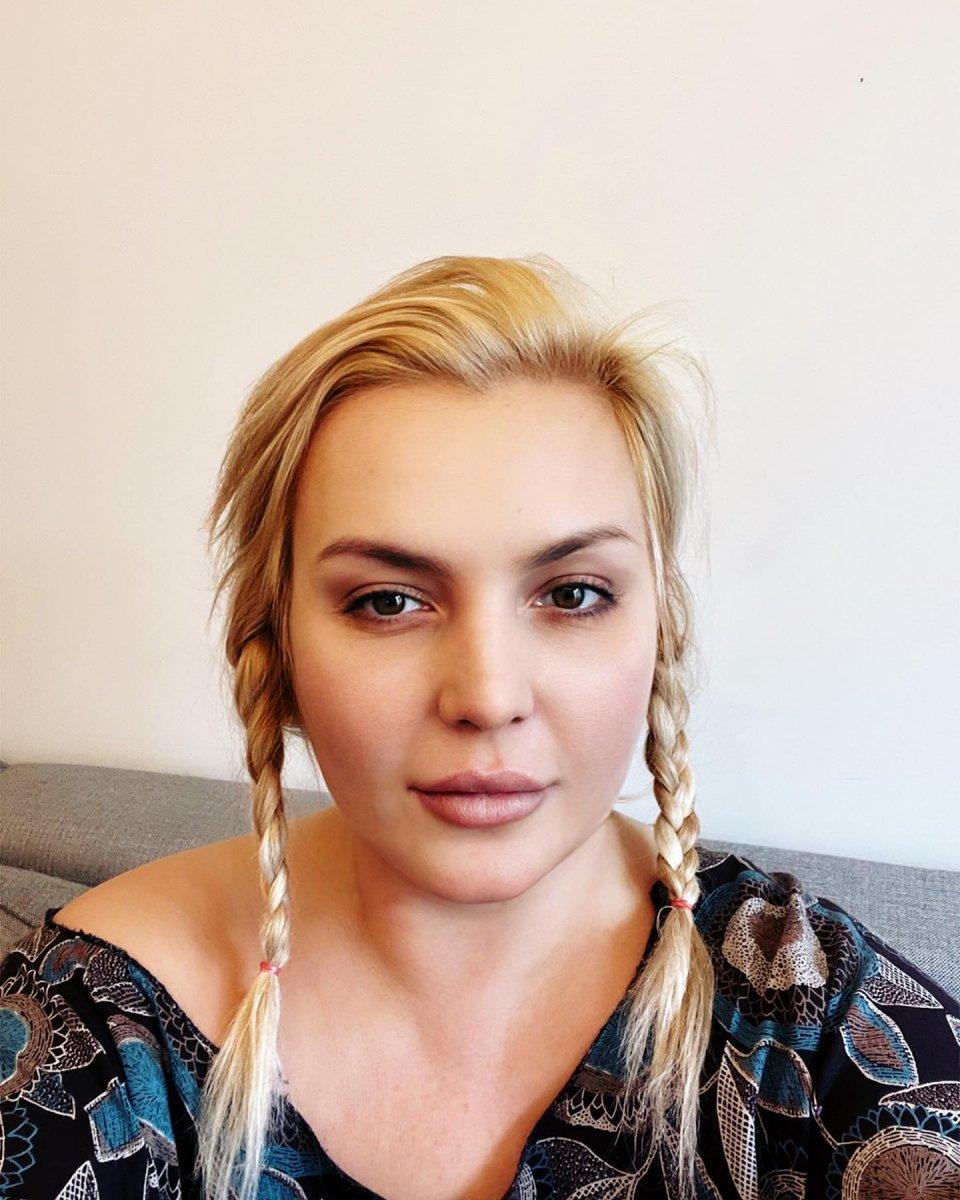 Seda Akgül'ün son hali şaşırttı