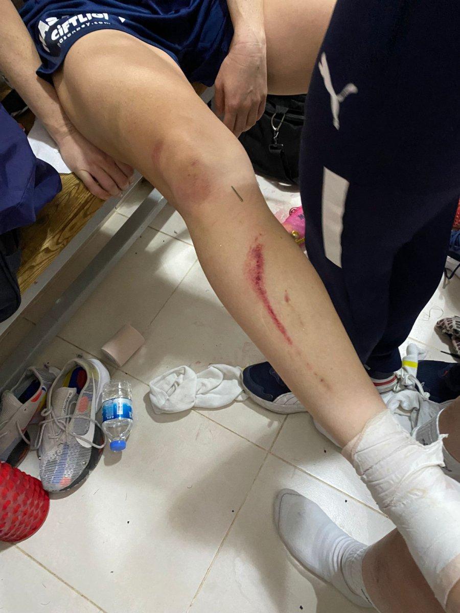 Amed Sportif - Fenerbahçe kadın futbol maçında kavga