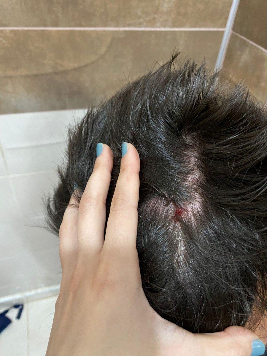 Amed Sportif - Fenerbahçe kadın futbol maçında kavga