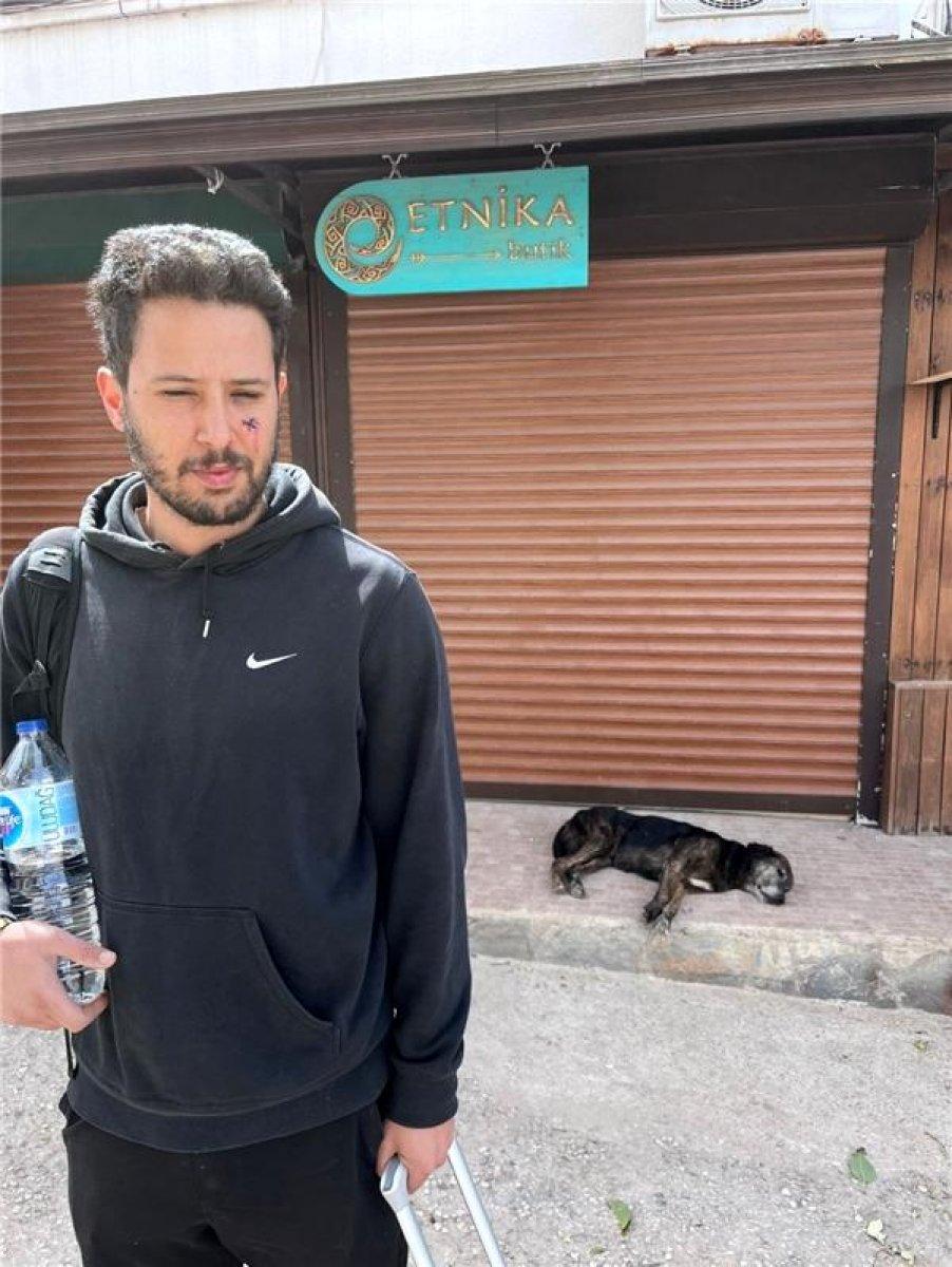 Tuan Tunalı'ya köpek saldırdı