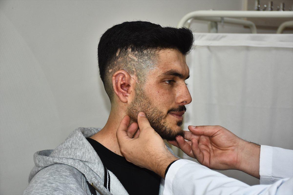 Karaman'da göğüs kafesi dokusundan kulak yapıldı