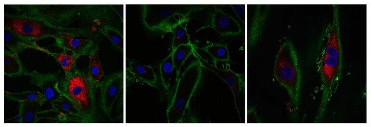 İngiltere'de 53 yaşındaki kadın 30 yıl gençleştirildi