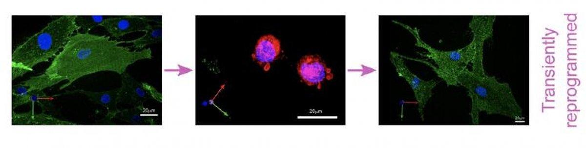 İngiltere'de 53 yaşındaki kadın 30 yıl gençleştirildi