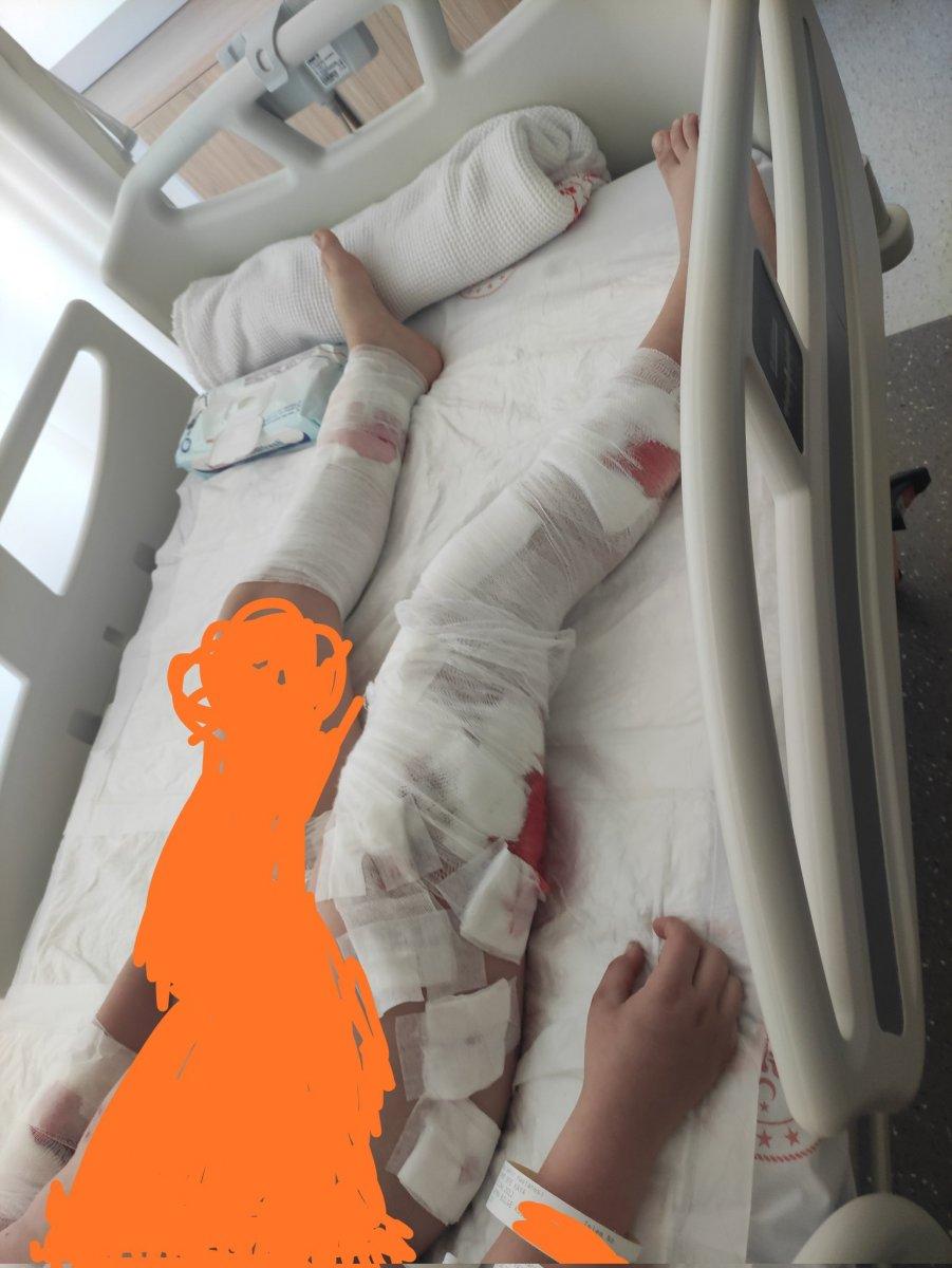 Bursa'da 8 köpek, okula giden çocuğa saldırdı