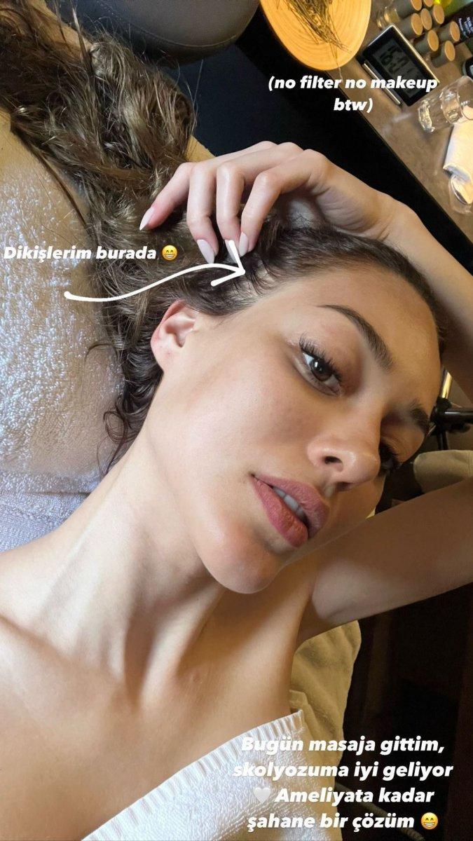 Dilan Çiçek Deniz'den masaj pozu geldi