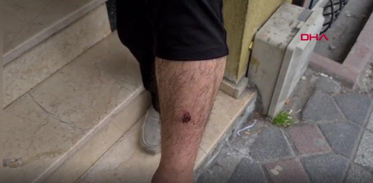 Sultangazi'de, evine giderken tekme tokat darbedildi