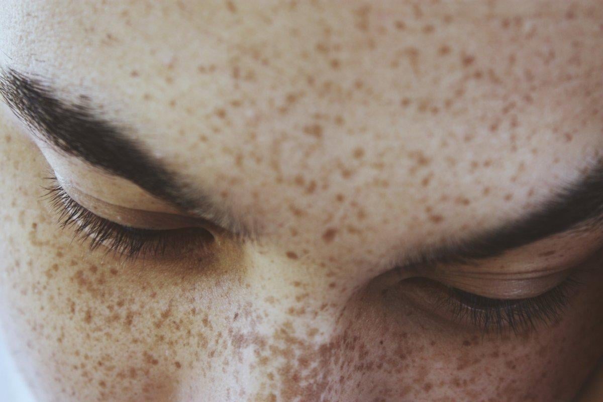 Çok garip ve nadir 10 hastalık