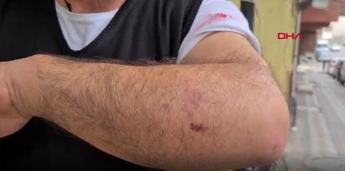 Sultangazi'de, evine giderken tekme tokat darbedildi