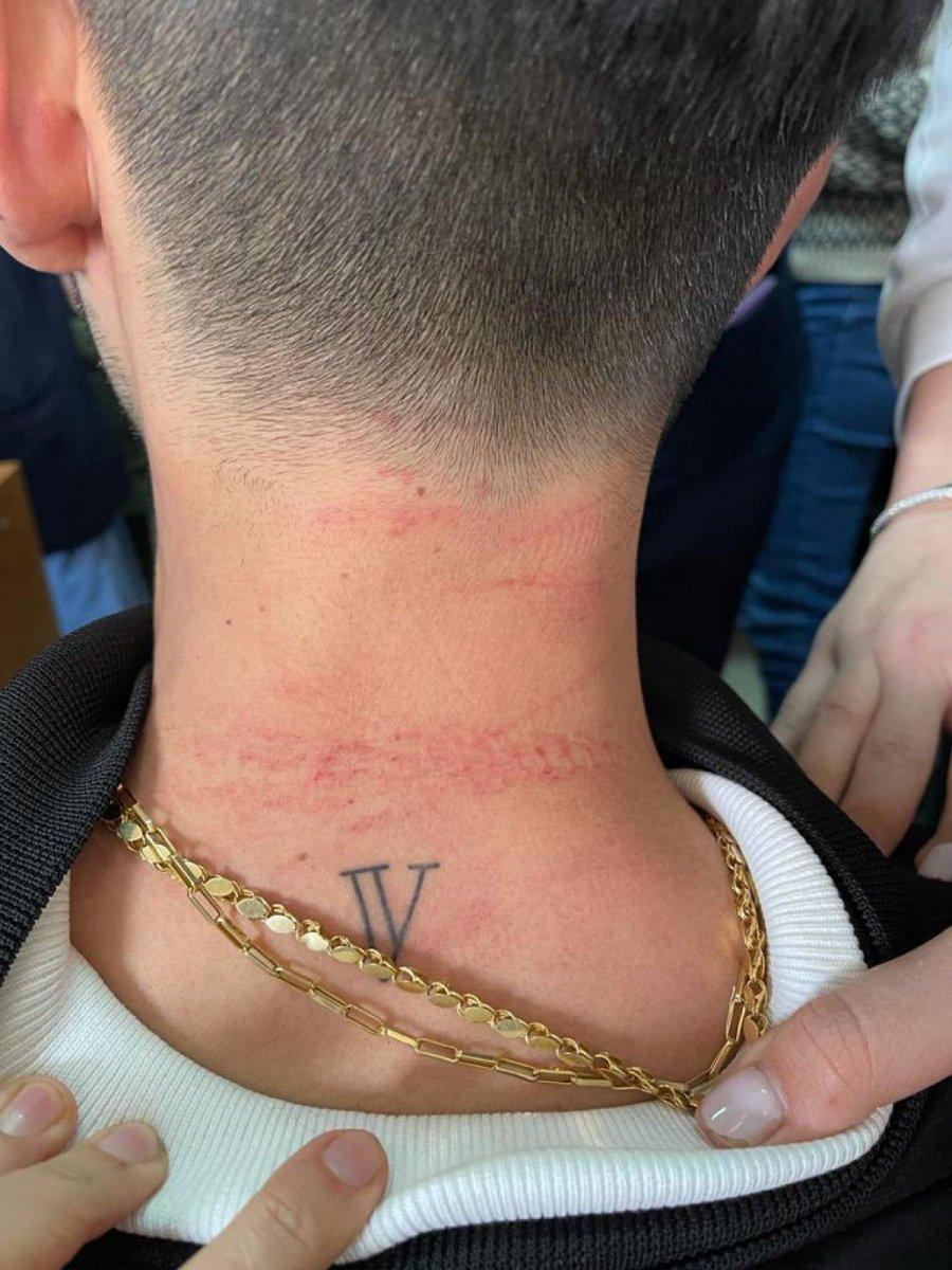 Cerrahpaşa'da doktoru döven sanık hakkında istenen ceza