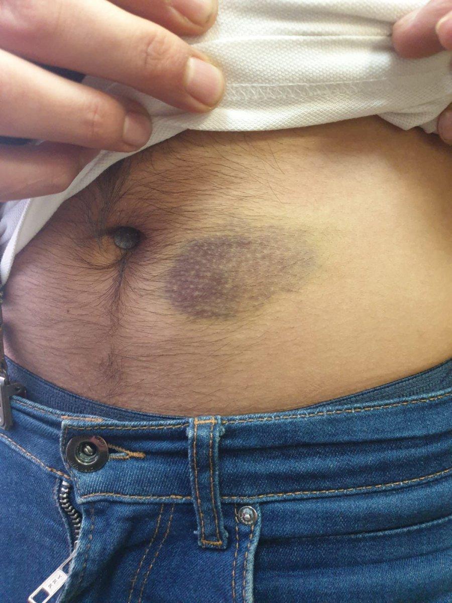 Cerrahpaşa'da doktoru döven sanık hakkında istenen ceza