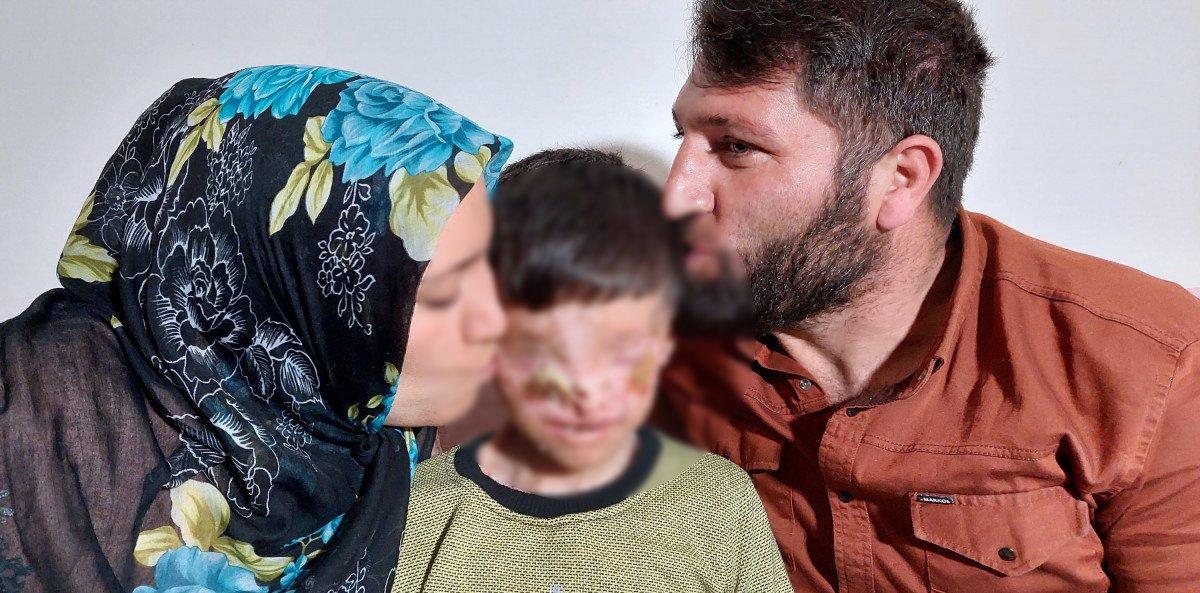 Erzurum'da cilt kanserinden gözleri kapanan Salih: Ailemi görmek istiyorum