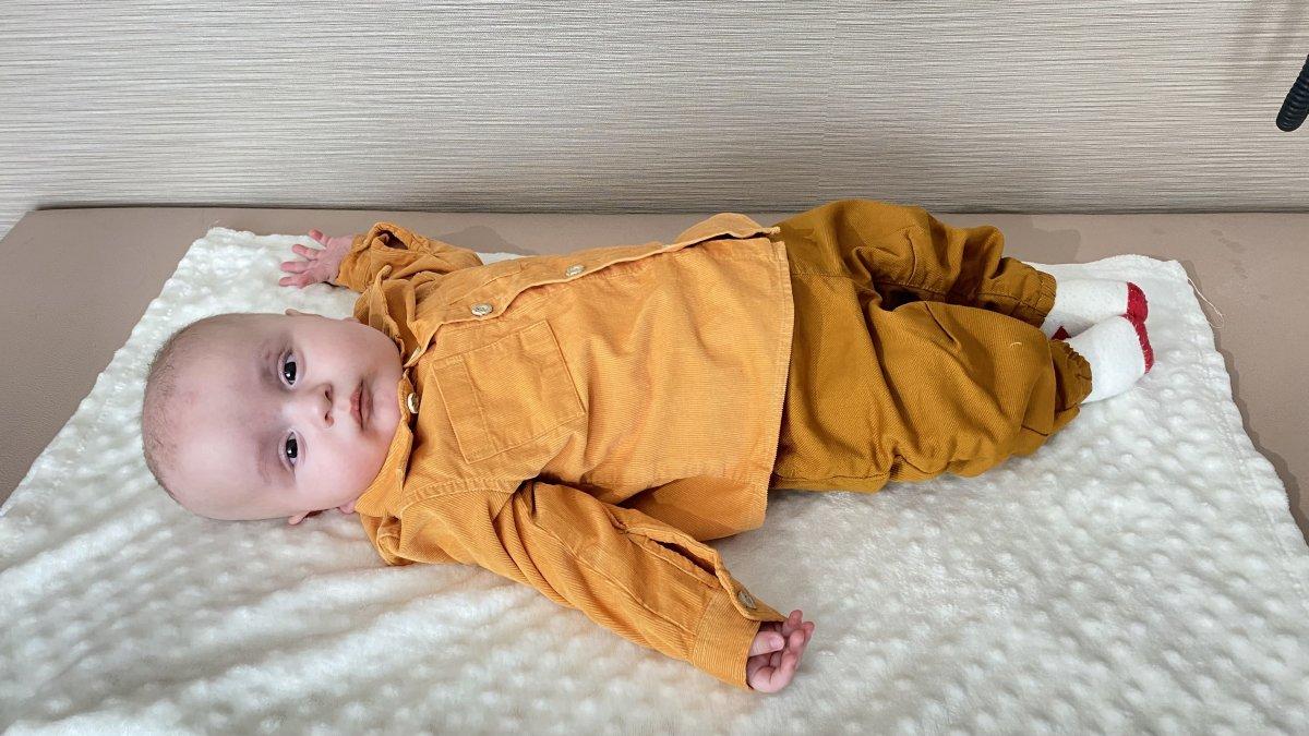 Erzurum'da 200 bin bir görülen hastalıkla doğdu, annesinin karaciğeri ile yaşama tutundu