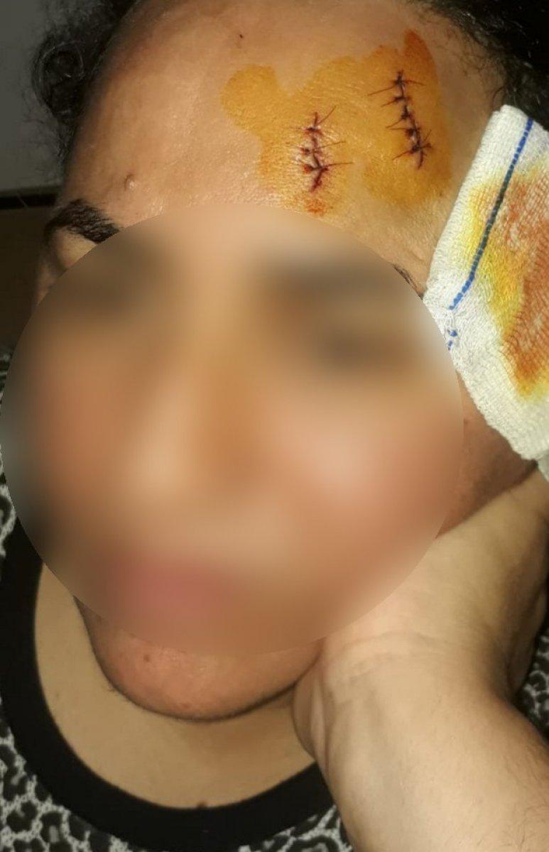 Adana’da komşusuna tencere ile saldırdı