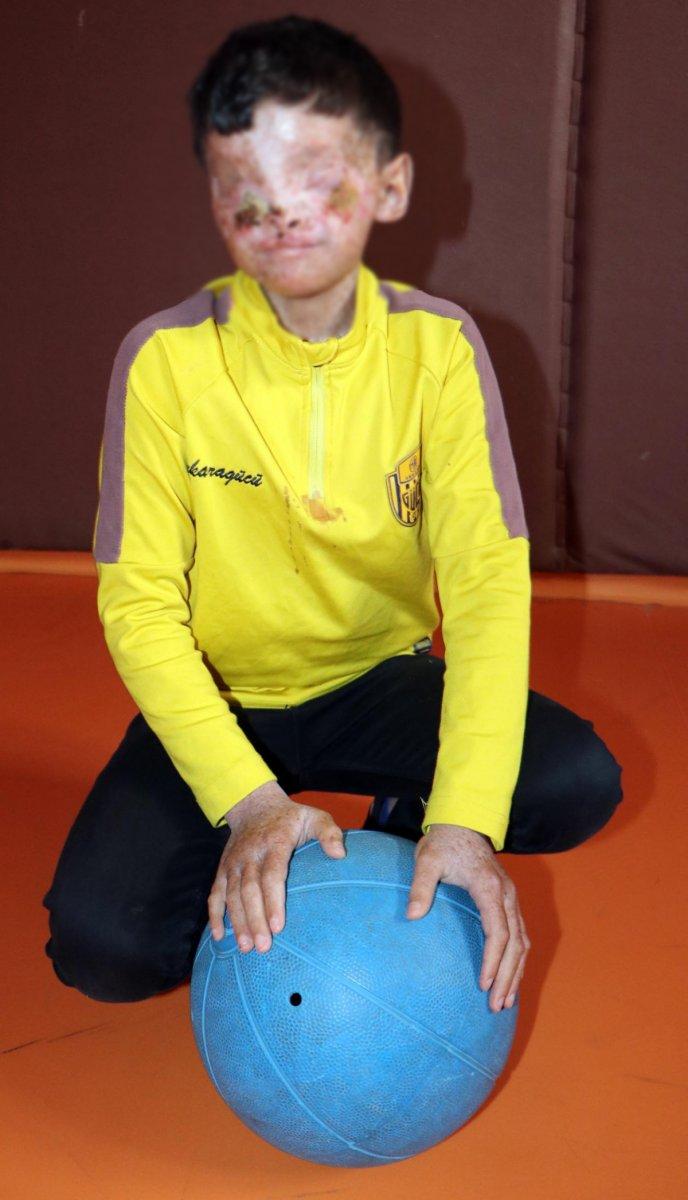 Erzurum'da cilt kanserinden gözleri kapanan Salih: Ailemi görmek istiyorum