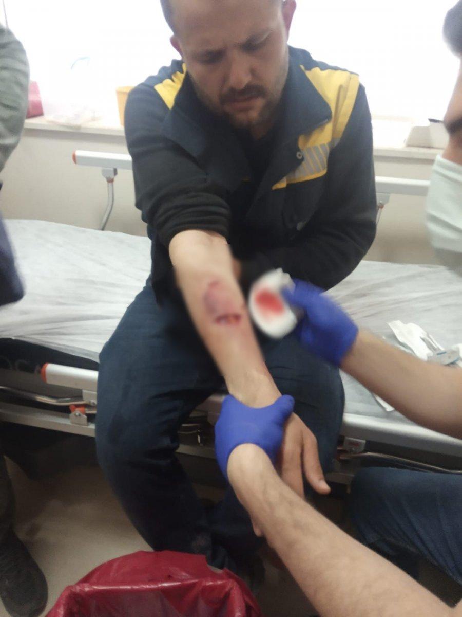 Adıyaman'da sayaç okuma görevlisine sokak köpekleri saldırdı