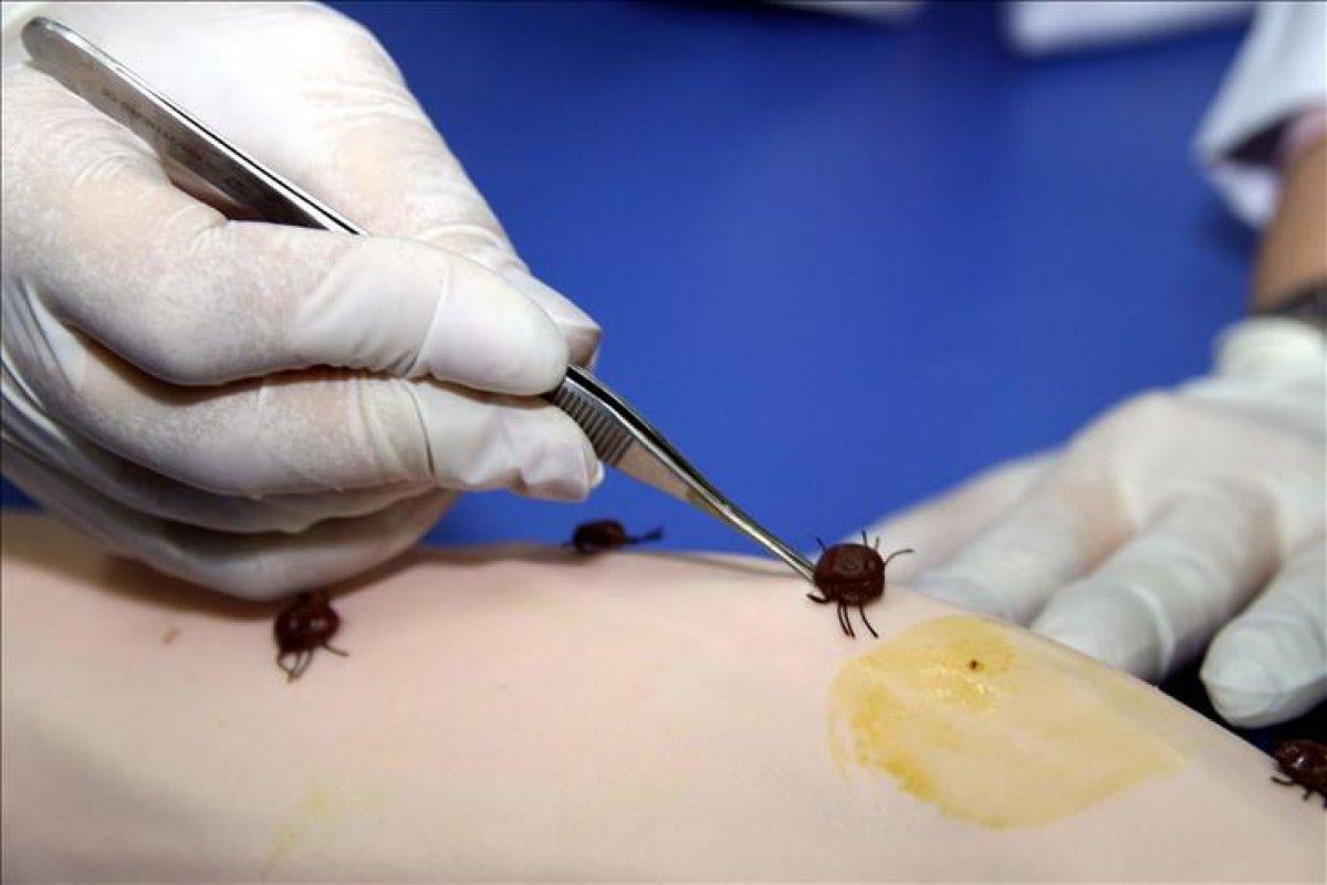 Türkiye'deki ilk kene vakası Tokat'ta görüldü