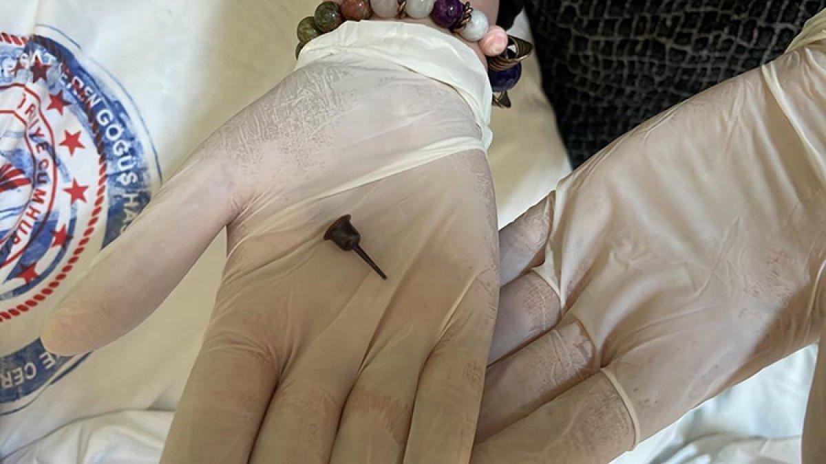 İzmir'de, soluk borusundaki mum tutacağından 9 yıl sonra kurtuldu