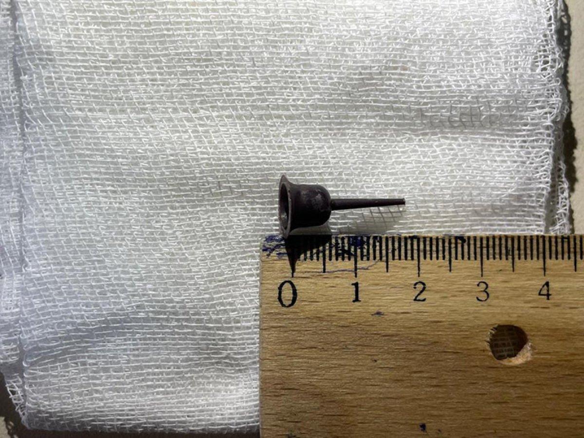 İzmir'de, soluk borusundaki mum tutacağından 9 yıl sonra kurtuldu