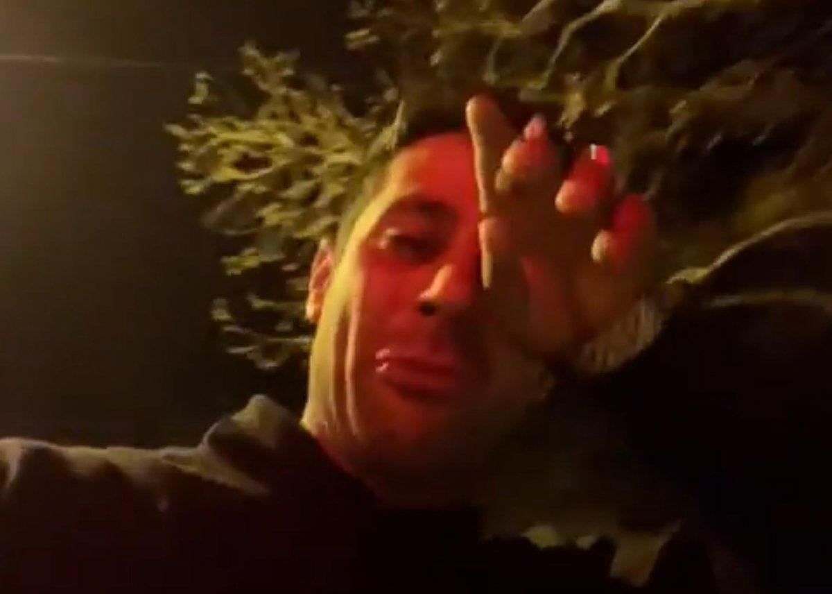 Antalya’da köpek gezdirme kavgası: Muhtar, odunla saldırmaya kalktı