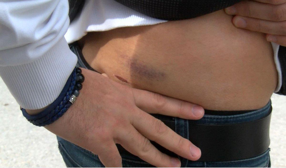 Maltepe’de başıboş köpeklerin vatandaşa saldırdığı anlar