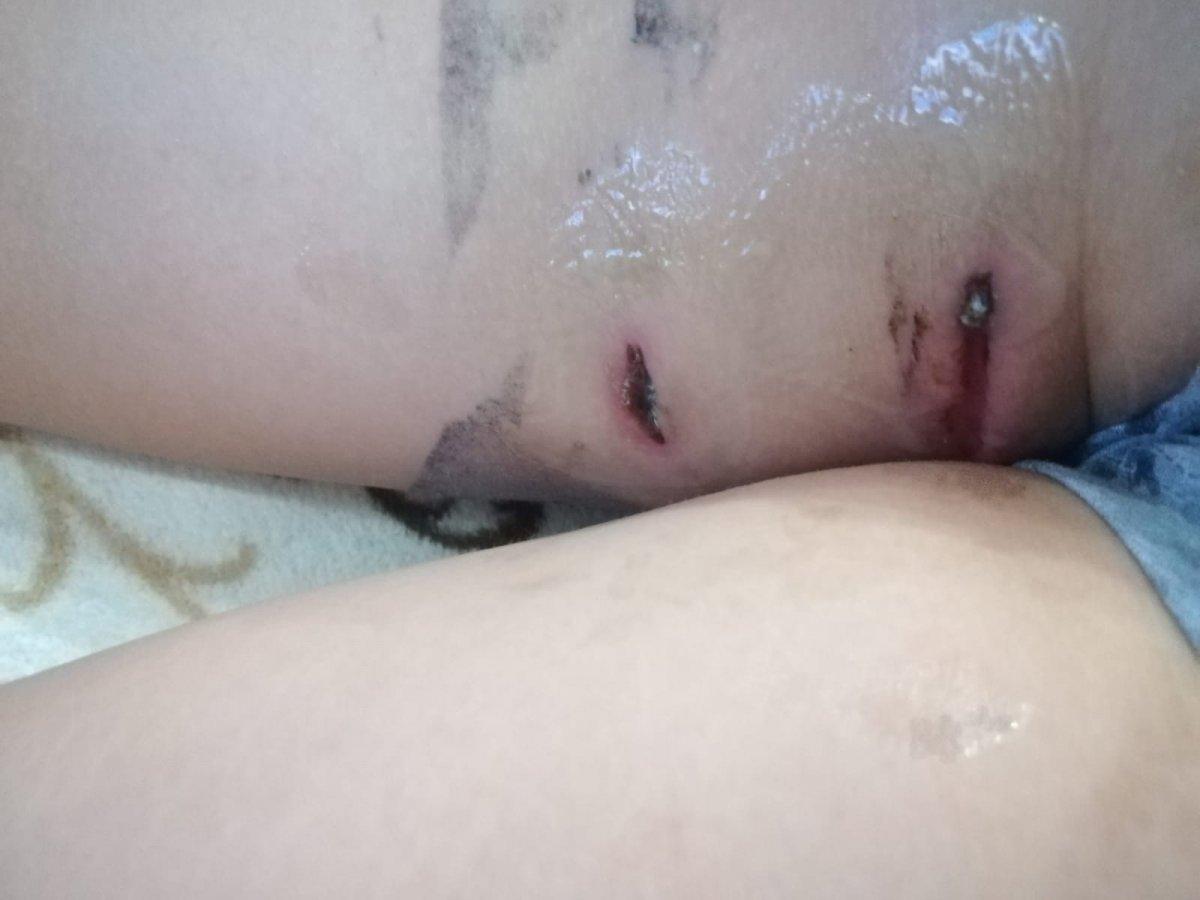 Denizli'de sokak köpekleri minik Tahir'e saldırdı