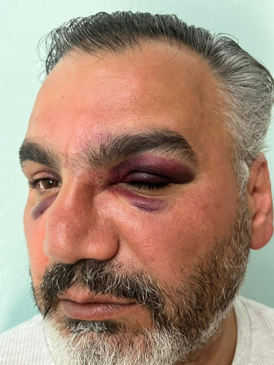 Denizli'ye gelen gurbetçi magandaların hedefi oldu