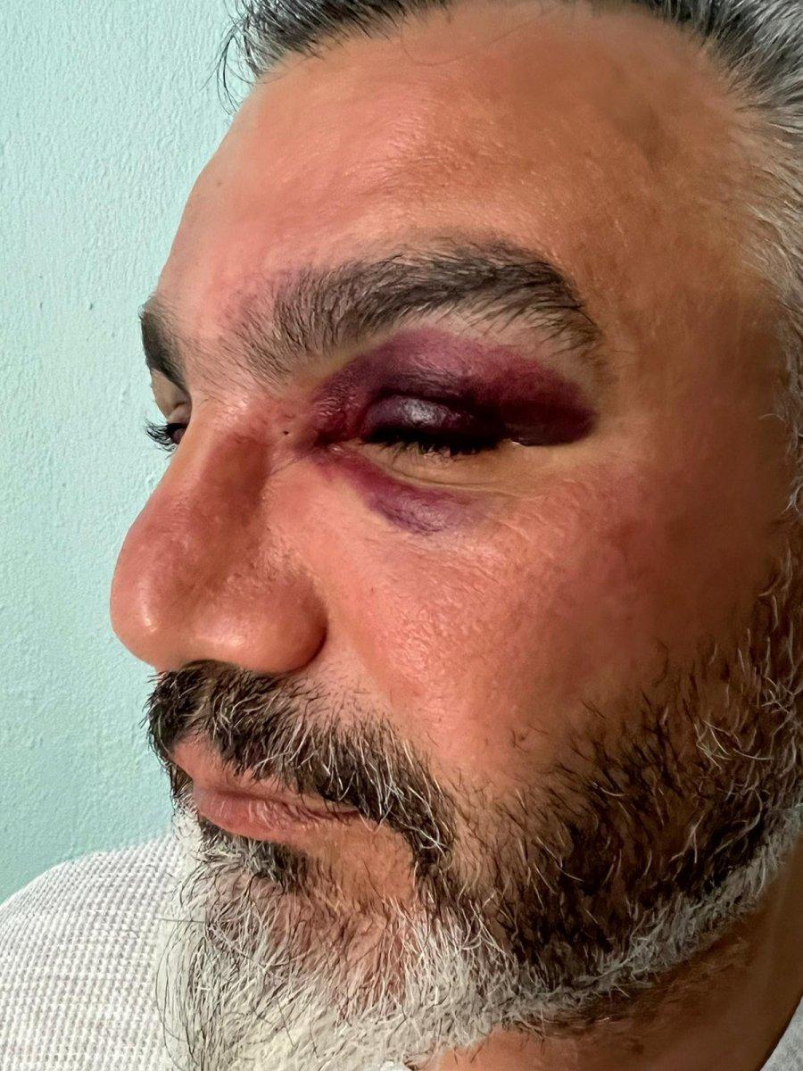 Denizli'ye gelen gurbetçi magandaların hedefi oldu