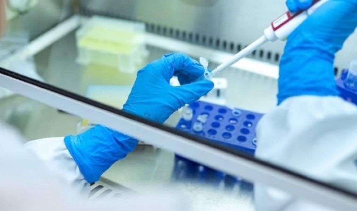 DSÖ: Avrupa ve ABD'de 169 