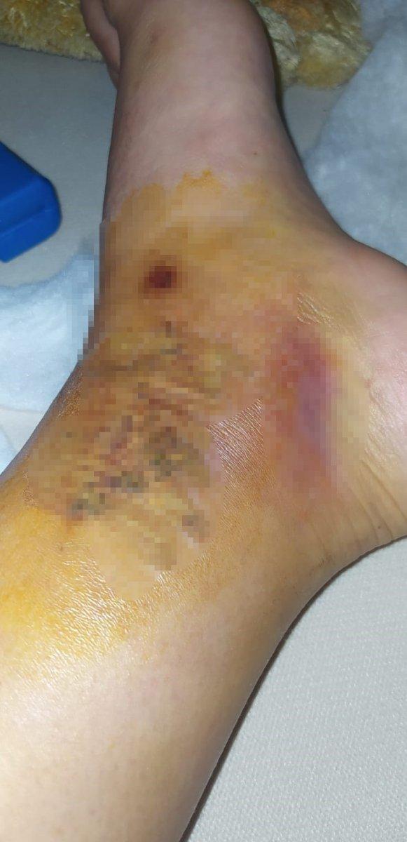 Ankara'da 3 kişiyi yaralayan alkollü sürücüye tutuklama