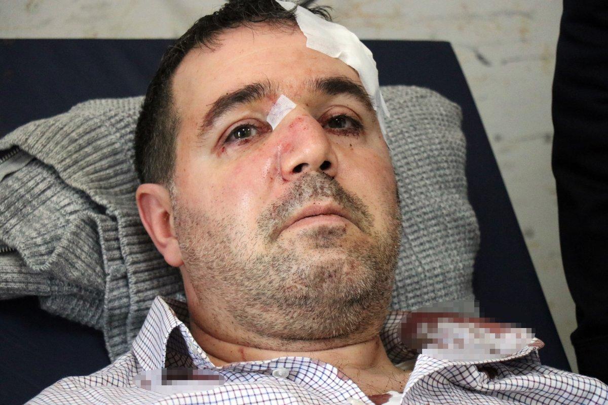 Sakarya'da taciz iddiası: Doktoru darbetti