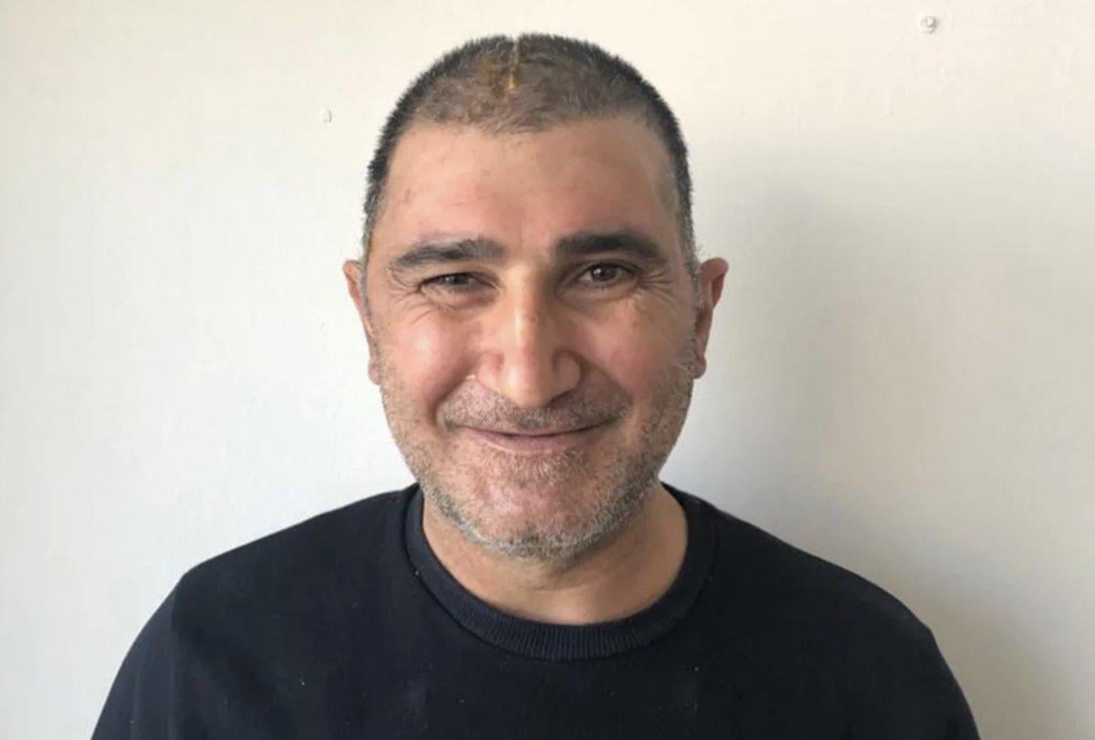 Kafatasının yüzde 83'ü parçalanan adam, yeni görüntüsüne kavuştu