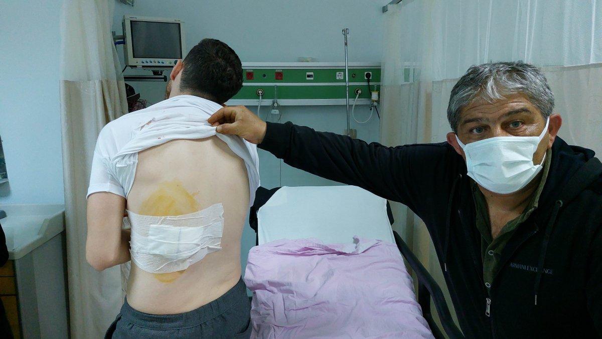 Samsun’da sokak köpeği kolunu ve sırtını ısırdı