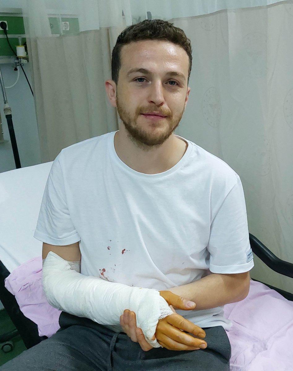 Samsun’da sokak köpeği kolunu ve sırtını ısırdı