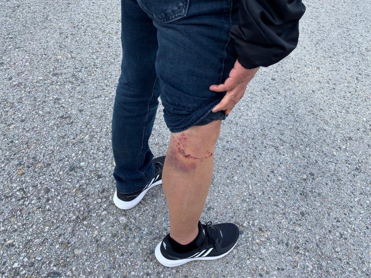 Ankara’daki mahallede 1 ayda 11 köpek saldırısı