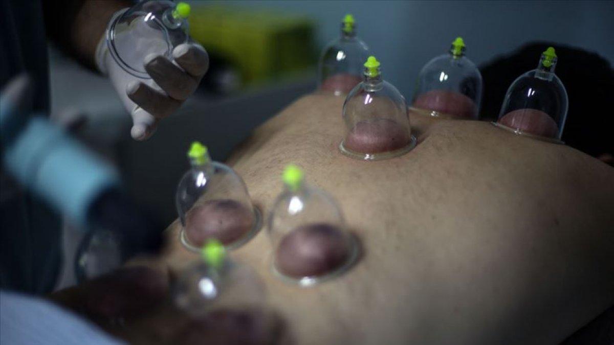 Hacamat günleri 2022: Mayıs ayında hangi günler hacamat yapılır?