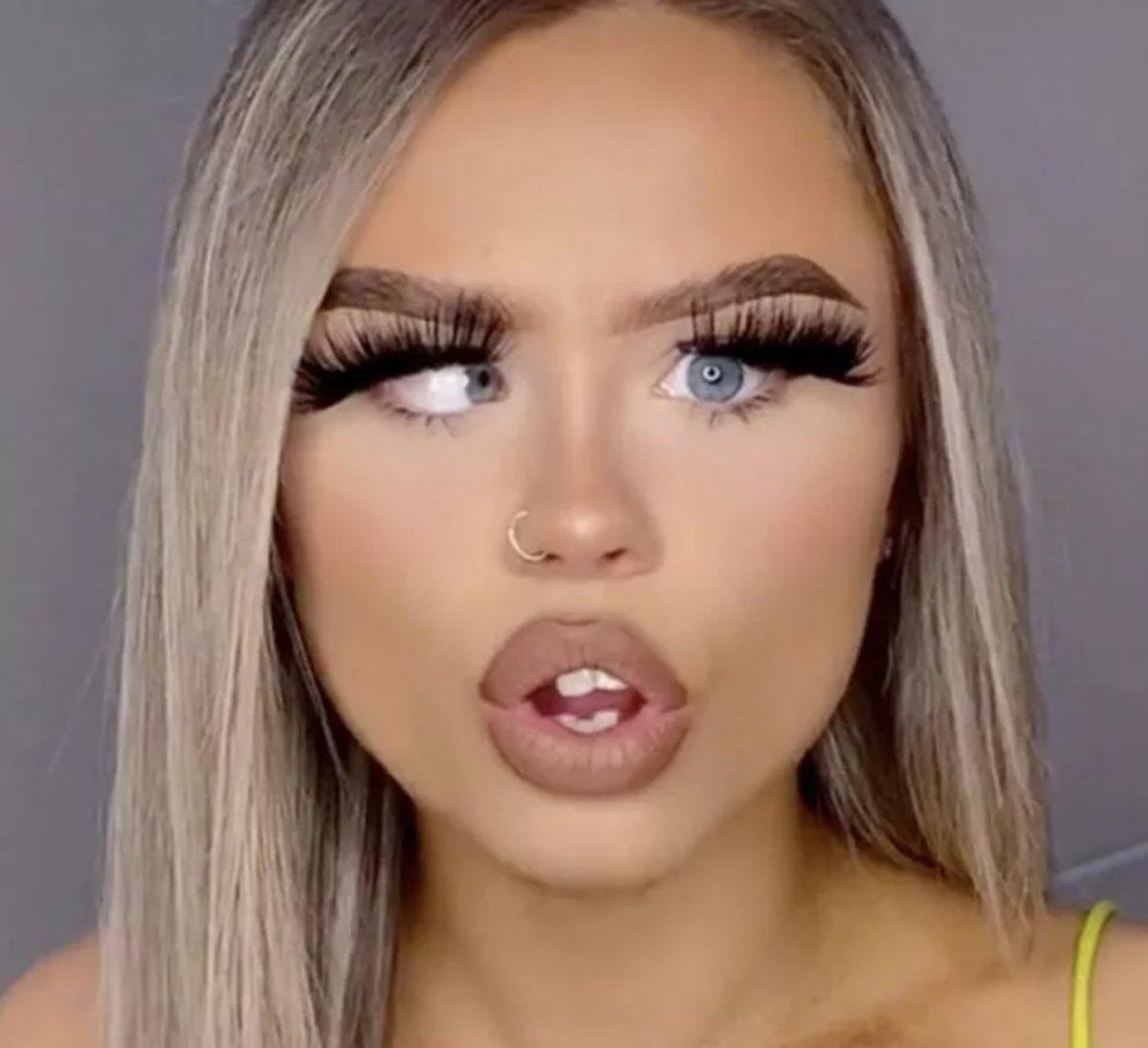 Göz rahatsızlığı genç kızı TikTok fenomeni yaptı