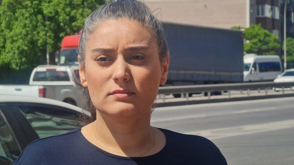 İzmit’te epilasyon sonrası kolları yandı